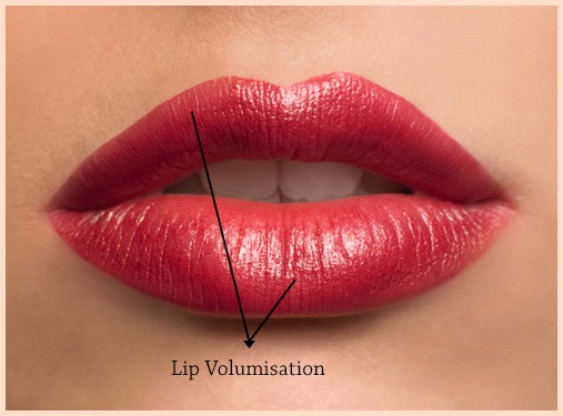 Lip fillers and augmentation